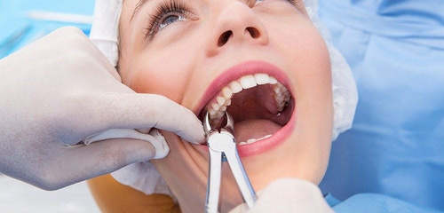 medium.com - All You Need To Know About Tooth Extraction